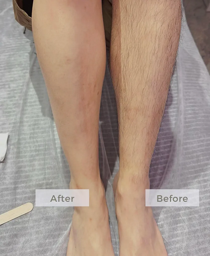 왁싱정보 - 호치민 왁싱 린란